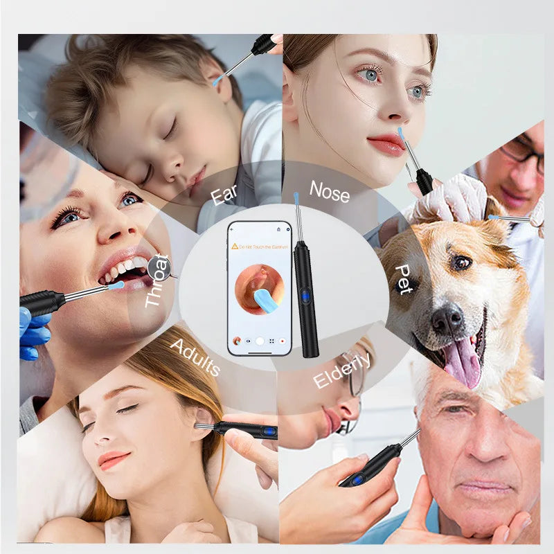 Visual Ear Wax Removal Kit with Camera 5M Luminous Otoscope Safe Ear Care Earwax Cleaner Endoscope Ear Cleaning Tools